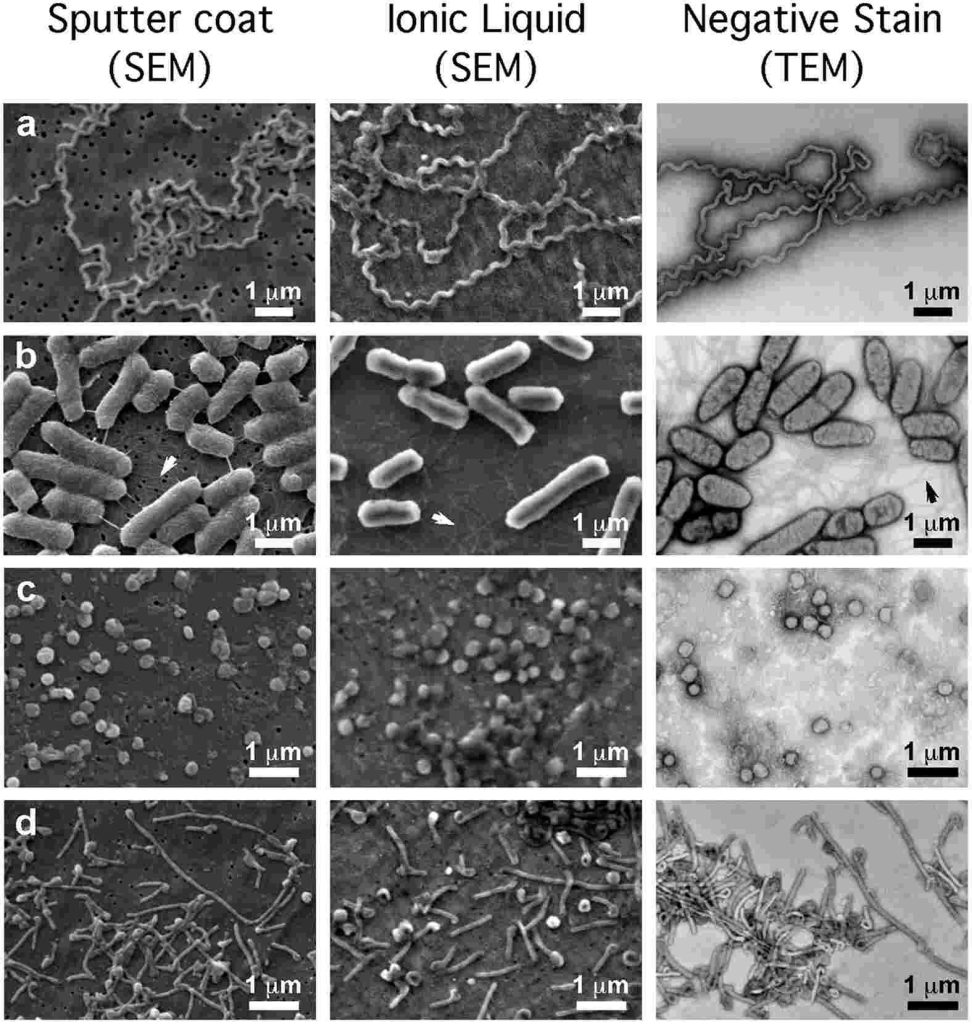 The scanning electron microscope